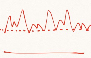 In real life, we have ups and downs.. and a bottom line.